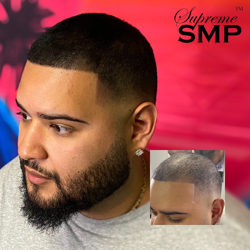 Img 4481: supreme smp Img 4481: supreme smp