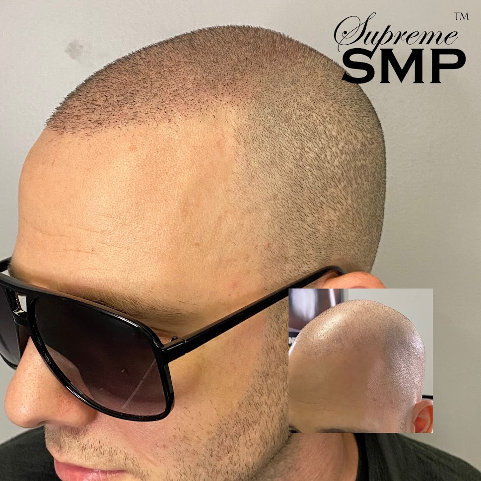 Img 6754: supreme smp Img 6754: supreme smp