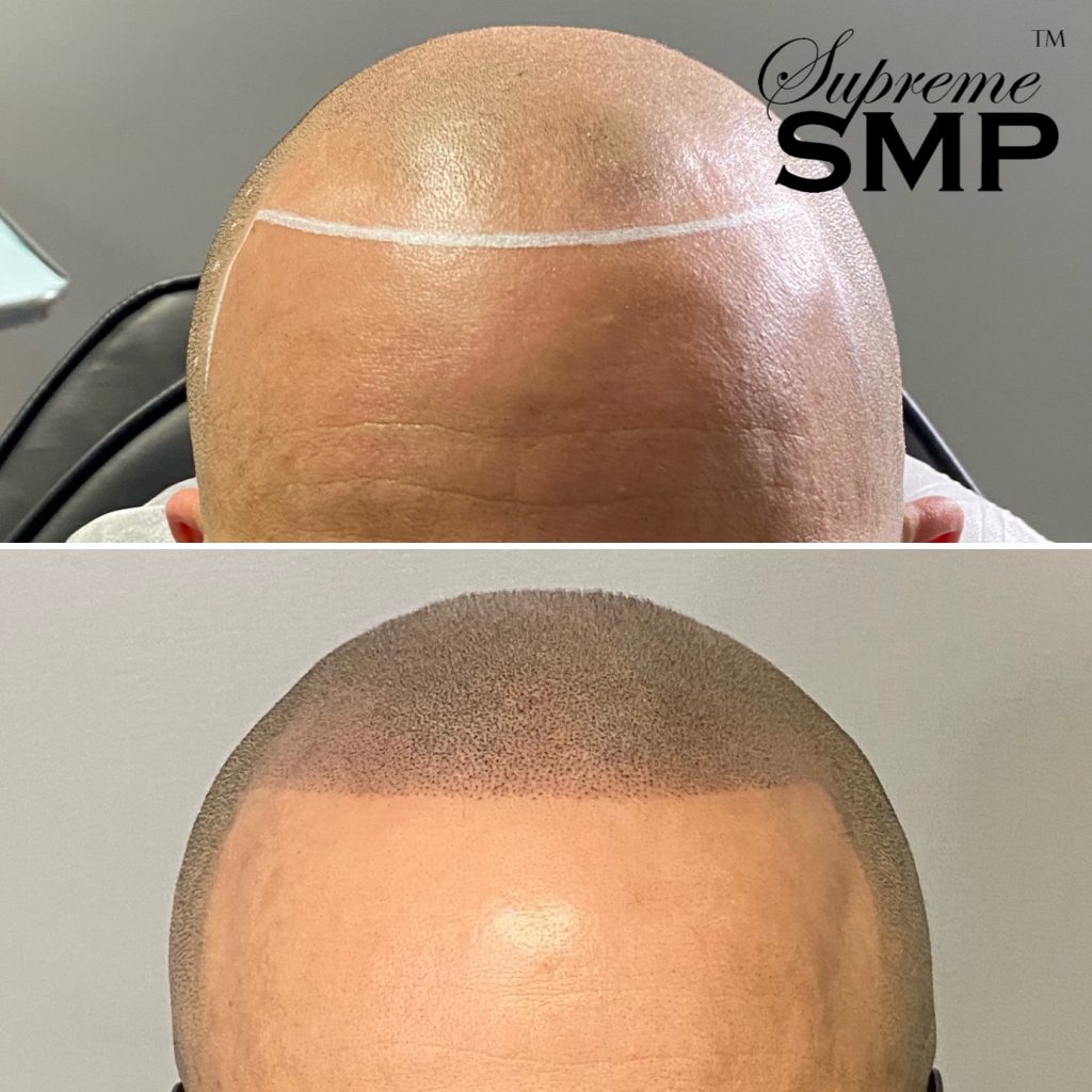 Smptechnique: supreme smp