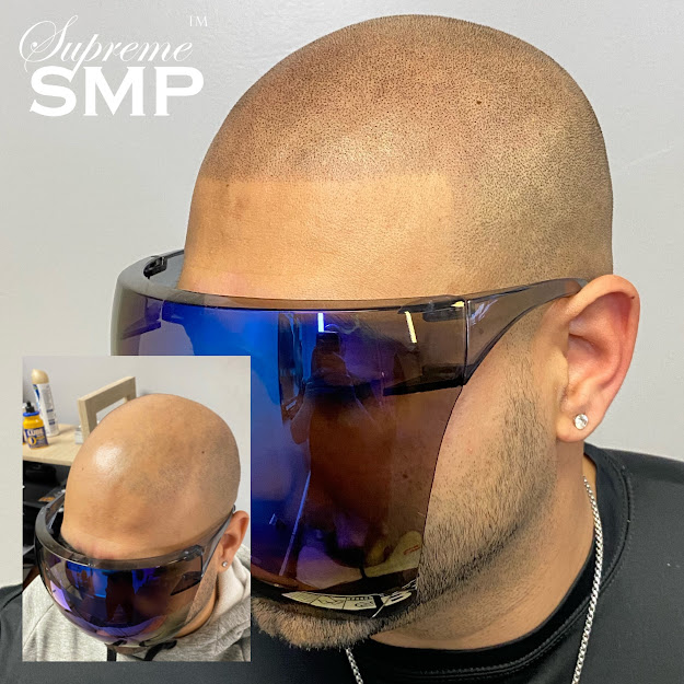 Whatissmp: supreme smp
