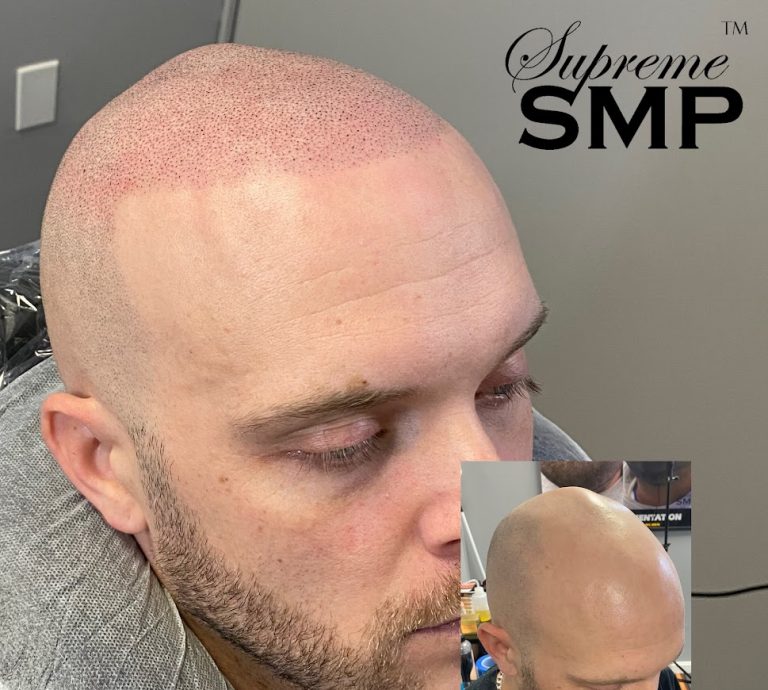 What pale skin actually needs from smp e1782285565654: supreme smp