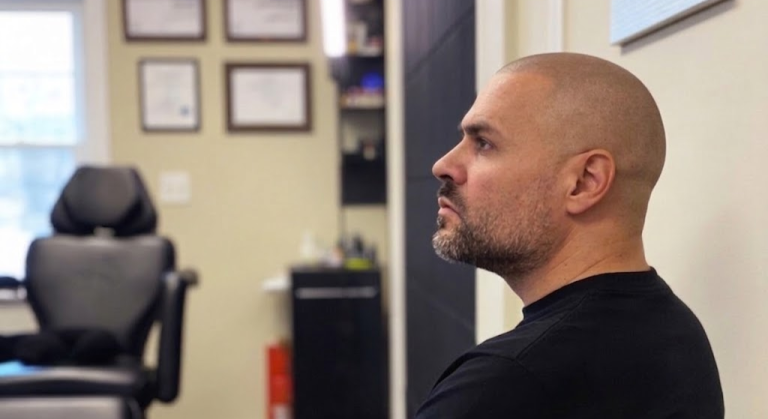5 real differences between a hair tattoo and a hair transplant: supreme smp